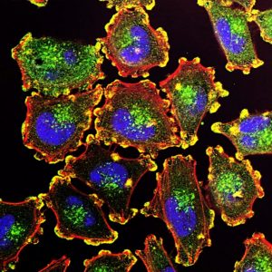 Spatialomics technology visualizes exactly where and when genes function, paving the way for new therapies. Image: National Cancer Institute.